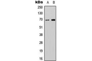 Image no. 1 for anti-Autophagy Related 16-Like 2 (ATG16L2) (Center) antibody (ABIN2705533)