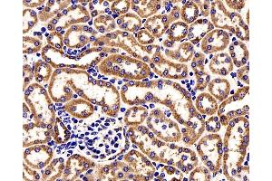 Immunohistochemistry analysis of paraffin-embedded Mouse kidney cancer using COX4I1 Polyclonal Antibody at dilution of 1:200.