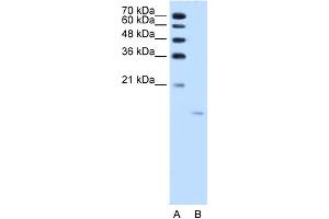 Image no. 3 for anti-Acid Phosphatase 1, Soluble (ACP1) (N-Term) antibody (ABIN2775279)