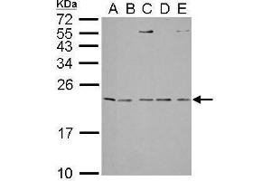 Image no. 5 for anti-Interleukin 1 Receptor Antagonist (IL1RN) (Center) antibody (ABIN2856394)