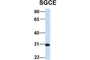 Image no. 6 for anti-Sarcoglycan, epsilon (SGCE) (N-Term) antibody (ABIN2782610)