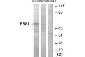 Image no. 1 for anti-Ets Variant 1 (ETV1) (AA 10-59) antibody (ABIN1533755)
