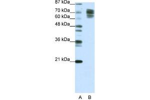 Image no. 4 for anti-Catenin (Cadherin-Associated Protein), beta 1, 88kDa (CTNNB1) (C-Term) antibody (ABIN2792303)