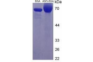 Image no. 2 for Androstenedione (ASD) protein (BSA) (ABIN1880277)