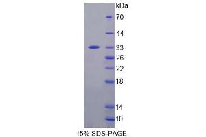 Maus 2 3 Cyclic Nucleotide 3 Phosphodiesterase Cnp Protein Recombinant Abin