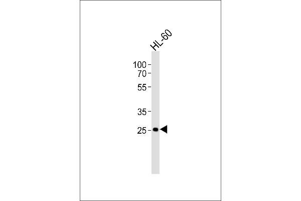 FCGR3B antibody  (N-Term)