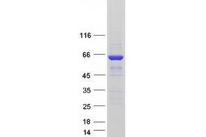 Image no. 1 for Sorting Nexin 27 (SNX27) protein (Myc-DYKDDDDK Tag) (ABIN2732403)