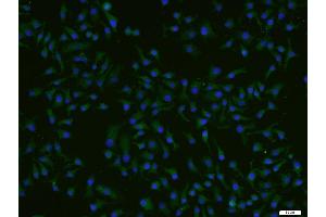 Image no. 2 for anti-AarF Domain Containing Kinase 4 (ADCK4) (AA 65-170) antibody (ABIN873007)