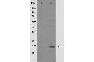 Image no. 2 for anti-Cathelicidin Antimicrobial Peptide (CAMP) (Internal Region) antibody (ABIN6260439)
