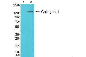 Image no. 1 for anti-Collagen, Type II (COL2) (N-Term) antibody (ABIN1848474)
