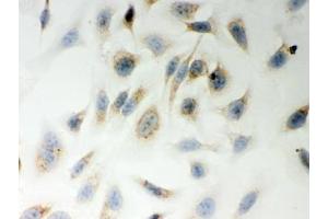ICC testing of FFPE human HeLa cells with LYRIC antibody.