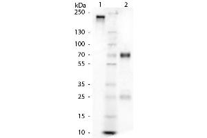 Image no. 1 for gamma Globulin Fraction protein (ABIN964142)
