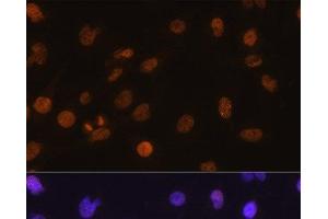 Immunofluorescence analysis of C6 cells using DDIT3 / CHOP Polyclonal Antibody at dilution of 1:100.