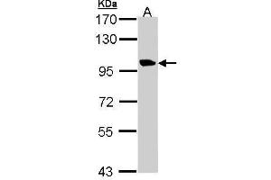 Image no. 1 for anti-Transmembrane Protein 67 (TMEM67) (Internal Region) antibody (ABIN2856740)
