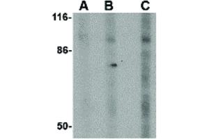 Image no. 1 for anti-Disrupted in Schizophrenia 1 (DISC1) (Internal Region) antibody (ABIN6655715)