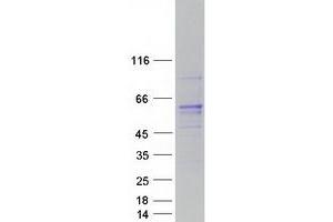 Image no. 1 for Regulator of Chromosome Condensation (RCC1) and BTB (POZ) Domain Containing Protein 1 (RCBTB1) protein (Myc-DYKDDDDK Tag) (ABIN2730650)