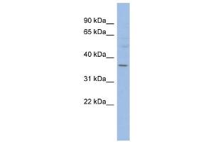Image no. 1 for anti-3-Hydroxymethyl-3-Methylglutaryl-CoA Lyase-Like 1 (HMGCLL1) (N-Term) antibody (ABIN632887)