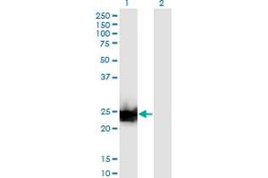 Image no. 3 for anti-Galectin 3 (LGALS3) (AA 1-250) antibody (ABIN1326929)