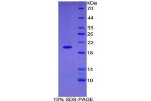 Image no. 4 for Matrix Metallopeptidase 9 (Gelatinase B, 92kDa Gelatinase, 92kDa Type IV Collagenase) (MMP9) ELISA Kit (ABIN6730931)