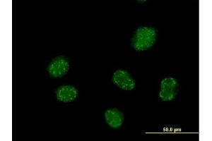 Immunofluorescence of purified MaxPab antibody to ELAC1 on HeLa cell.