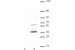 Image no. 3 for anti-Keratin 4 (KRT4) (pSer170) antibody (ABIN6971567)