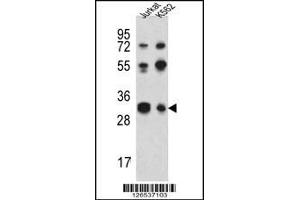Image no. 1 for anti-TWIST Neighbor (TWISTNB) (C-Term) antibody (ABIN2491709)