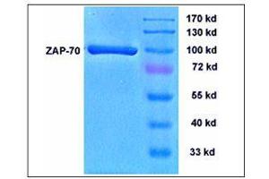 Image no. 1 for zeta-Chain (TCR) Associated Protein Kinase 70kDa (ZAP70) (Active) protein (ABIN411959)