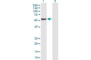 Image no. 1 for anti-Iroquois Homeobox Protein 2 (IRX2) (AA 1-471) antibody (ABIN531056)