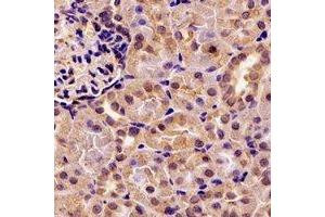 Image no. 1 for anti-Pancreatic Lipase (PNLIP) antibody (ABIN2966875)