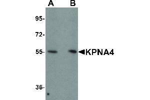 Image no. 1 for anti-Karyopherin (Importin) alpha 4 (KPNA4) (N-Term) antibody (ABIN6657033)