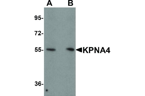 anti-Karyopherin (Importin) alpha 4 (KPNA4) (N-Term) antibody