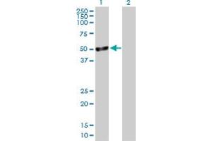 Western Blot analysis of TSSK1B expression in transfected 293T cell line by TSSK1B MaxPab polyclonal antibody.