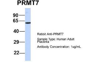 Image no. 2 for anti-Protein Arginine Methyltransferase 7 (PRMT7) (N-Term) antibody (ABIN2778659)