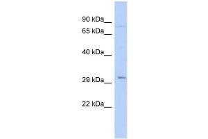 Image no. 1 for anti-Paired-Like Homeodomain 2 (PITX2) (N-Term) antibody (ABIN2779637)