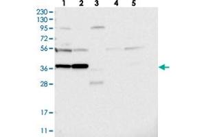 Image no. 2 for anti-Prune Homolog 2 (PRUNE2) antibody (ABIN5586284)