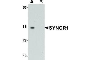Image no. 1 for anti-Synaptogyrin 1 (SYNGR1) (Internal Region) antibody (ABIN6656389)