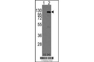 Western Blotting (WB) image for anti-Cancer Susceptibility Candidate 3 (CASC3) antibody (ABIN2158044)