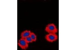 Image no. 1 for anti-Protein Phosphatase 1, Regulatory (Inhibitor) Subunit 14A (PPP1R14A) (N-Term) antibody (ABIN2801446)