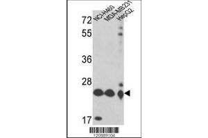 Image no. 1 for anti-Peroxiredoxin 3 (PRDX3) (AA 66-94), (N-Term) antibody (ABIN389470)