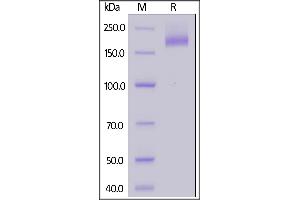 SARS-CoV Spike Protein (AA 14-1195) (His tag)