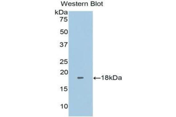 anti-Fibronectin Type III Domain Containing 5 (FNDC5) (AA 2-137) antibody