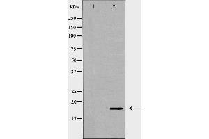 Image no. 1 for anti-Vesicle-Associated Membrane Protein 2 (Synaptobrevin 2) (VAMP2) (N-Term) antibody (ABIN6265943)