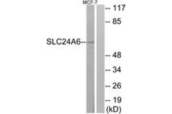 anti-Solute Carrier Family 24 (Sodium/potassium/calcium Exchanger), Member 6 (SLC24A6) (AA 494-543) antibody