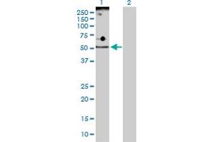 Western Blot analysis of ADPGK expression in transfected 293T cell line by ADPGK MaxPab polyclonal antibody.