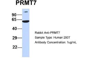 Image no. 1 for anti-Protein Arginine Methyltransferase 7 (PRMT7) (N-Term) antibody (ABIN2778659)