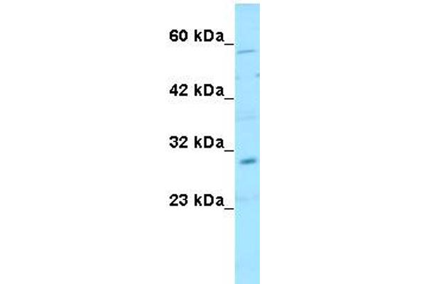 anti-SNAIL (SNAI1) (N-Term) antibody