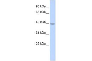Image no. 1 for anti-Methionine Adenosyltransferase II, beta (MAT2B) (N-Term) antibody (ABIN2786400)