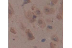 Image no. 2 for anti-Melanoma Associated Chondroitin Sulfate Proteoglycan (MCSP) (AA 1135-1444) antibody (ABIN1174256)