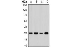 Image no. 1 for anti-Acidic (Leucine-Rich) Nuclear phosphoprotein 32 Family, Member A (ANP32A) (full length) antibody (ABIN6005236)