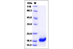 Image no. 1 for Baculoviral IAP Repeat-Containing 5 (BIRC5) (AA 1-142) protein (ABIN2002660)
